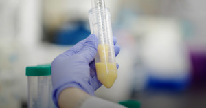 HIV부터 치매까지...줄기세포 치료, 난치성 질환으로 영역 확장 - 뉴스 썸네일 이미지